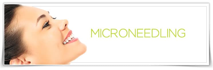 Microneedling - available for Hood River, The Dalles and surrounding areas in Oregon and Washington at Columbia Laser Skin Center
